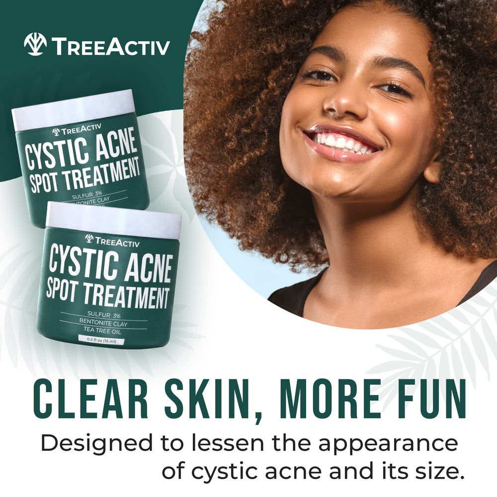 TreeActiv bentonite clay sulfur formula close-up highlighting purifying texture and active ingredients.