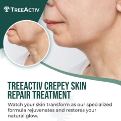 TreeActiv Cream texture close-up reveals rich, hydrating formula for crepey skin