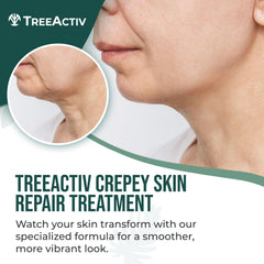 Texture closeup of TreeActiv crepey skin repair cream for smooth application