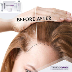 Tricomax bottle suggests nails and skin nourishment alongside hair benefits.