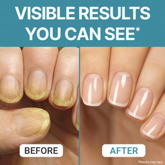Triple Clear HF helps brittle nails feel stronger with daily use.