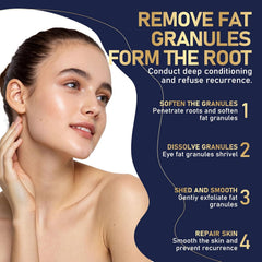 TROMED Milia Remover with salicylic acid exfoliates gently for pores.