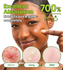 Easy application on clean, dry skin for fast use