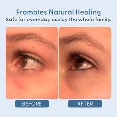 Twenty/Twenty Easy On The Eyes lashes cleansing close-up demonstrates debris removal.