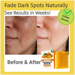 Shea butter-rich formula image suggesting deep moisturization for soft skin.