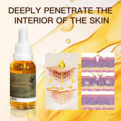 UWPU Organic Rosehip Oil scar application promotes smoother texture.