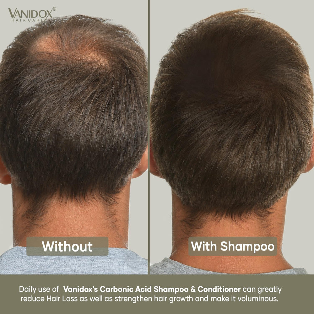 VANIDOX scalp care close-up conveys soothing hydration for sensitive scalps.