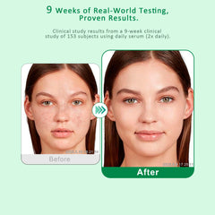 VBBV lightweight serum absorbing quickly into the skin