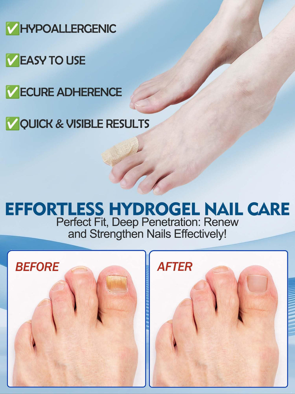 Vealvion Nail Patches used overnight for renewal potential