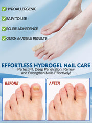 Vealvion Nail Patches used overnight for renewal potential