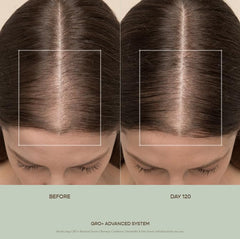 Close-up of GRO+ Serum ingredients highlighting polyphenol-rich actives.