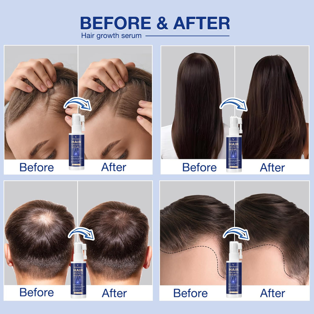 Venanoci Hair Growth Spray highlights rice water for strengthened hair health