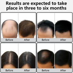 Verfubo electric scalp massager provides a comfortable, relaxing scalp treatment at home.