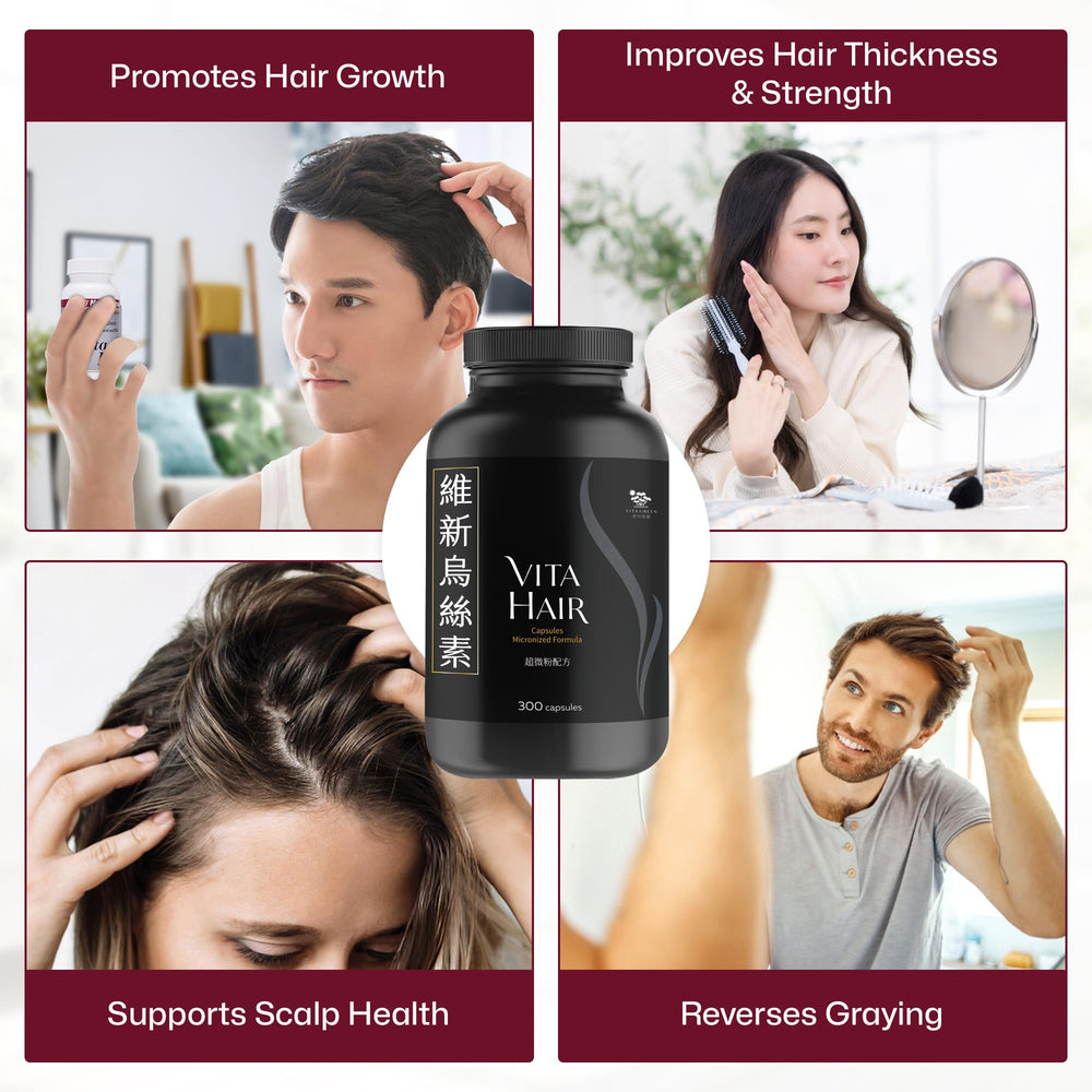 Vita Hair growth progress chart illustrating potential long-term improvements.