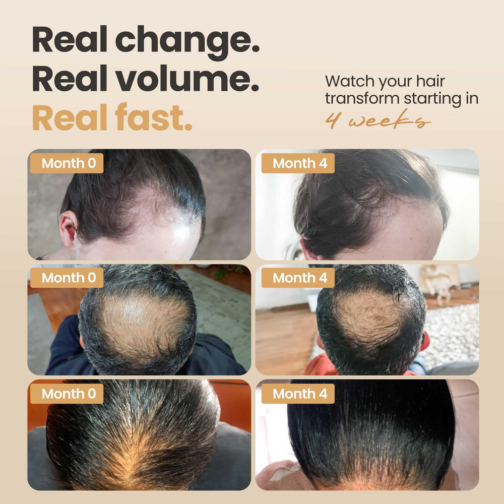 Vitasei Hair Booster application on scalp demonstrating root nourishment
