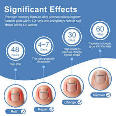 Vitasy size-3 corrector strip designed for curved nails