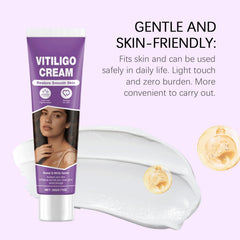 Applying Vitiligo Cream on arm demonstrates gentle, non-irritating care.