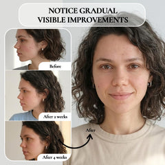 Close-up of nose area showing pores and gentle exfoliation with Vivo Per Lei gel.