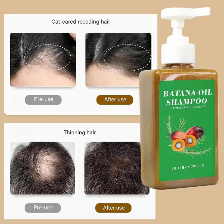 VJPPII Batana Oil Shampoo with rosemary extract emphasizes natural hair care benefits.