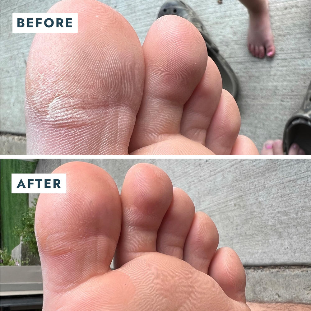 VOESH Solemate organic-olive-oil delivers rich hydration to heels.