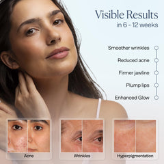 VogueNow LuminX Pro four modes offer red, blue, and near infrared wavelengths for versatile care.