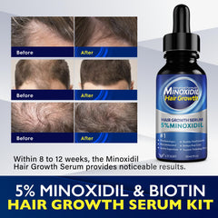 VTROUY Minoxidil scalp application shows targeted treatment for thinning hair