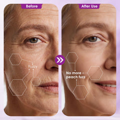 Three adjustable speeds tailor dermaplaning to your skin type.