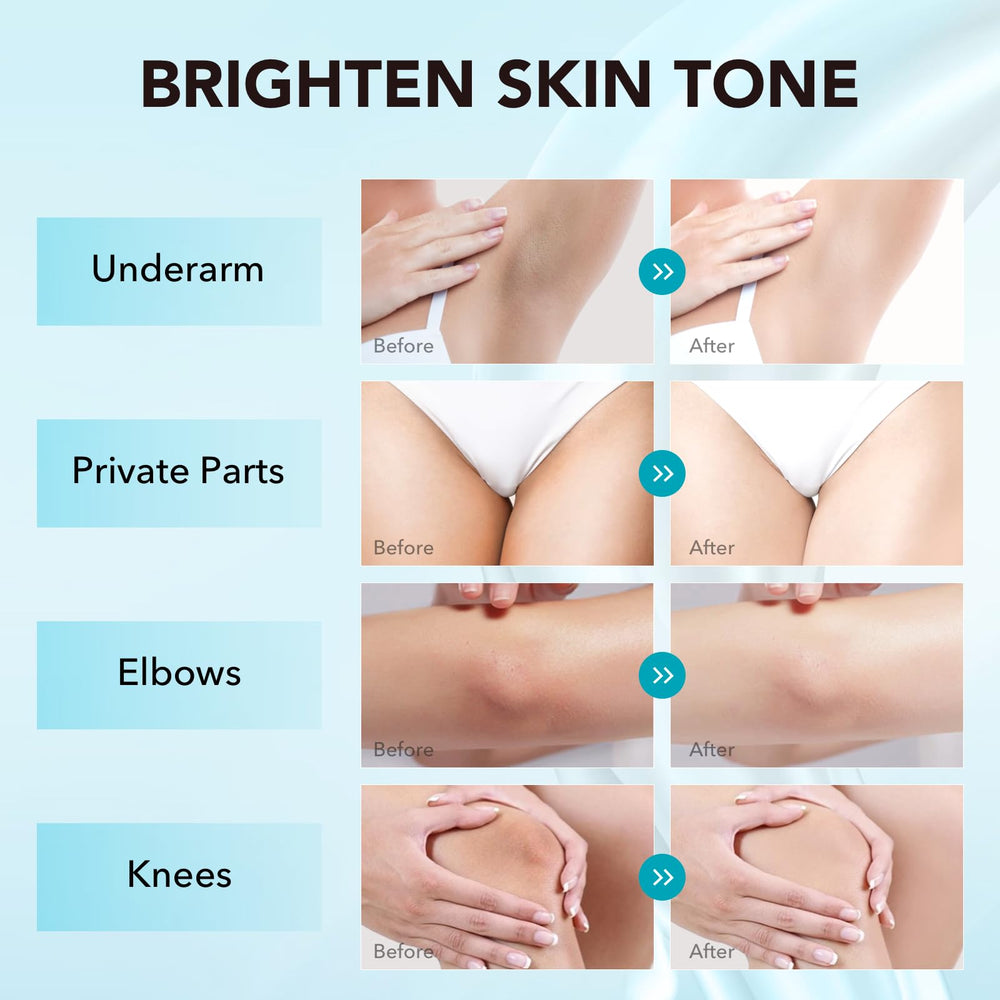 VZP Dark Spot Remover for elbows helping even skin tone with a light texture