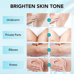 VZP Dark Spot Remover for elbows helping even skin tone with a light texture