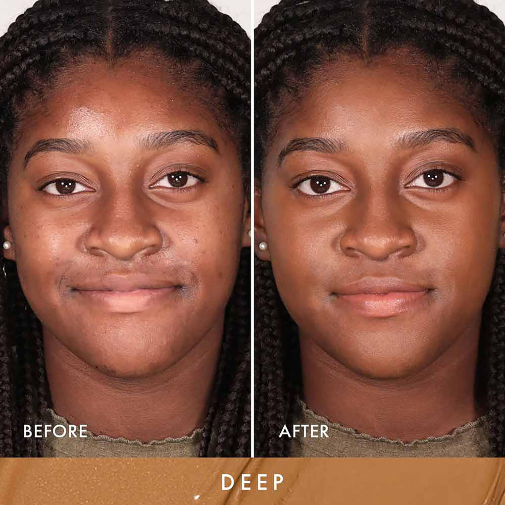 Wander Beauty Dualist 360 precision tip enables targeted spot coverage.