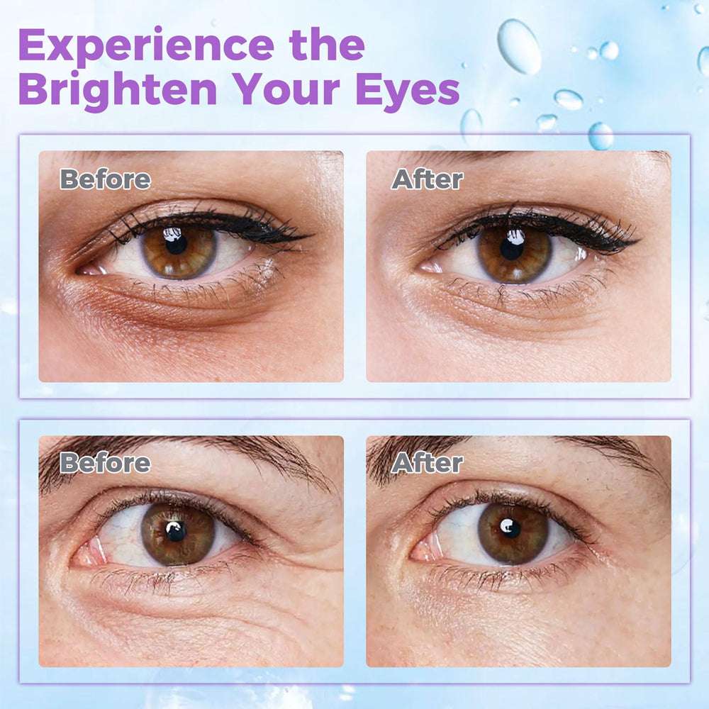 WEAUUP Eye Cream with hyaluronic acid for deep under-eye hydration.
