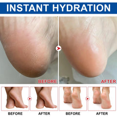 Weluno urea cream stick leaves skin visibly smoother after treatment.