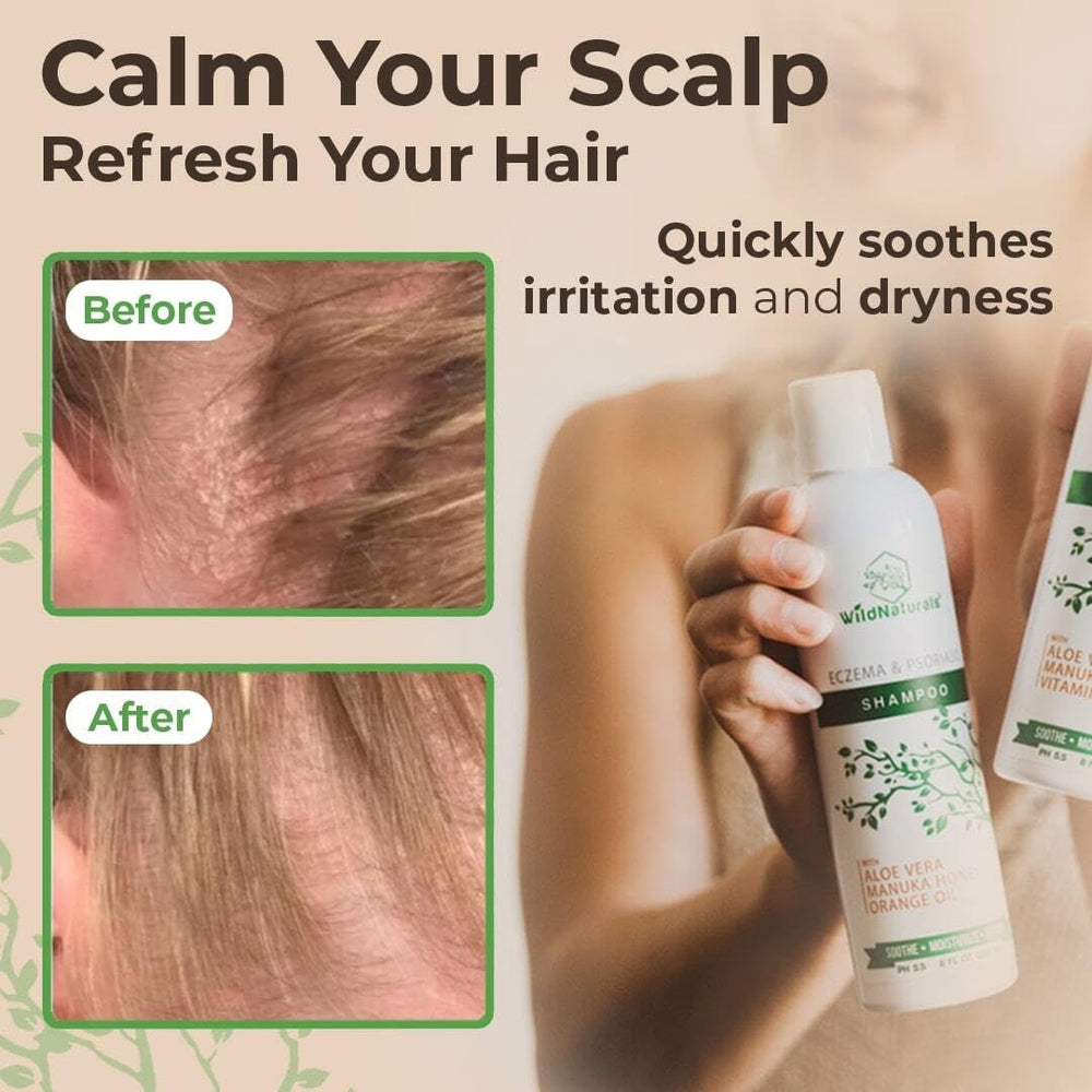 pH-balanced 5.5 formula supports sensitive skin in Wild Naturals.