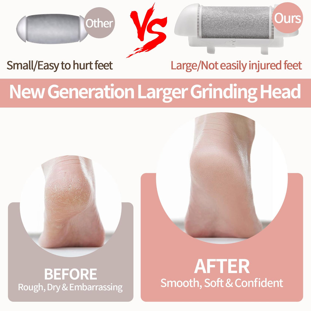 WisePulse regular roller head close up for softening daily calluses and maintenance
