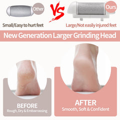 WisePulse regular roller head close up for softening daily calluses and maintenance