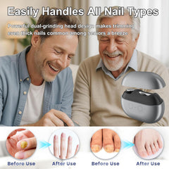 Witpiny All-in-one nail care device trims and polishes nails