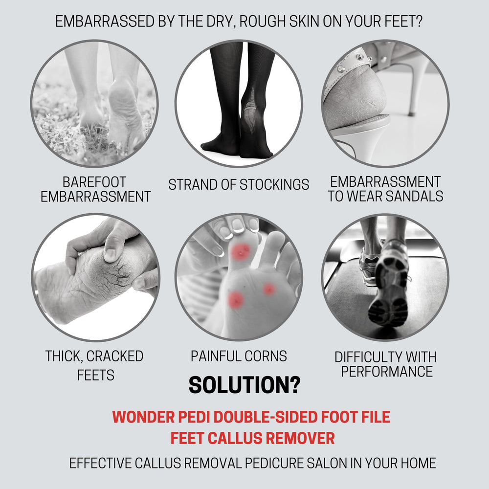 Wonder Pedi heel-care foot file ready to smooth dry, rough heels.