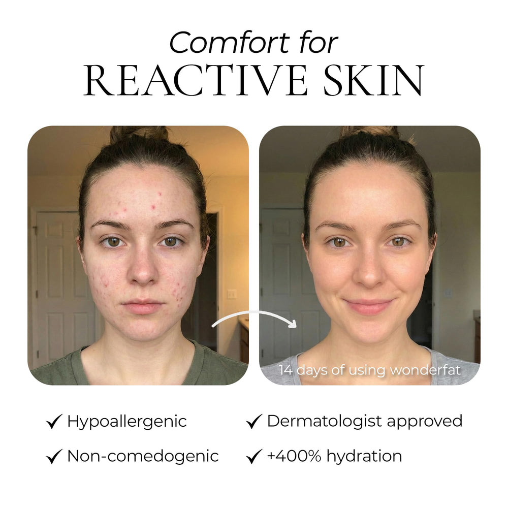 Wonderfat balm on body providing lightweight hydration for daily use