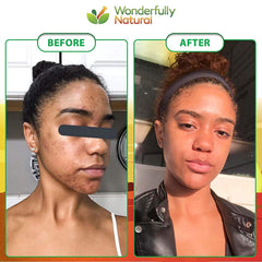 Wonderfully Natural African Black Soap ingredients list and ethical sourcing emphasis