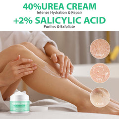 XIAMOFUZHOU Urea 40% smooth application on rough feet.