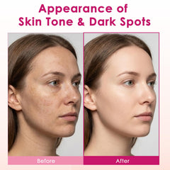 XILRVON Arbutin cream swatch on skin for even tone preview