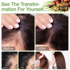 Applying Batana Oil to scalp with gentle massage for potential vitality.