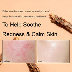 XUHUIT PDRN Rejuvenating Cream fragrance-free for sensitive skin.