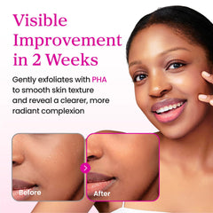 YADAH Collagen Hydra Essence contains niacinamide for gentle care