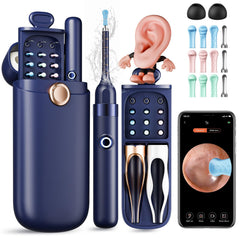 Yakbio Ear Cleaner Camera 1296P view reveals earwax detail for at home inspection.