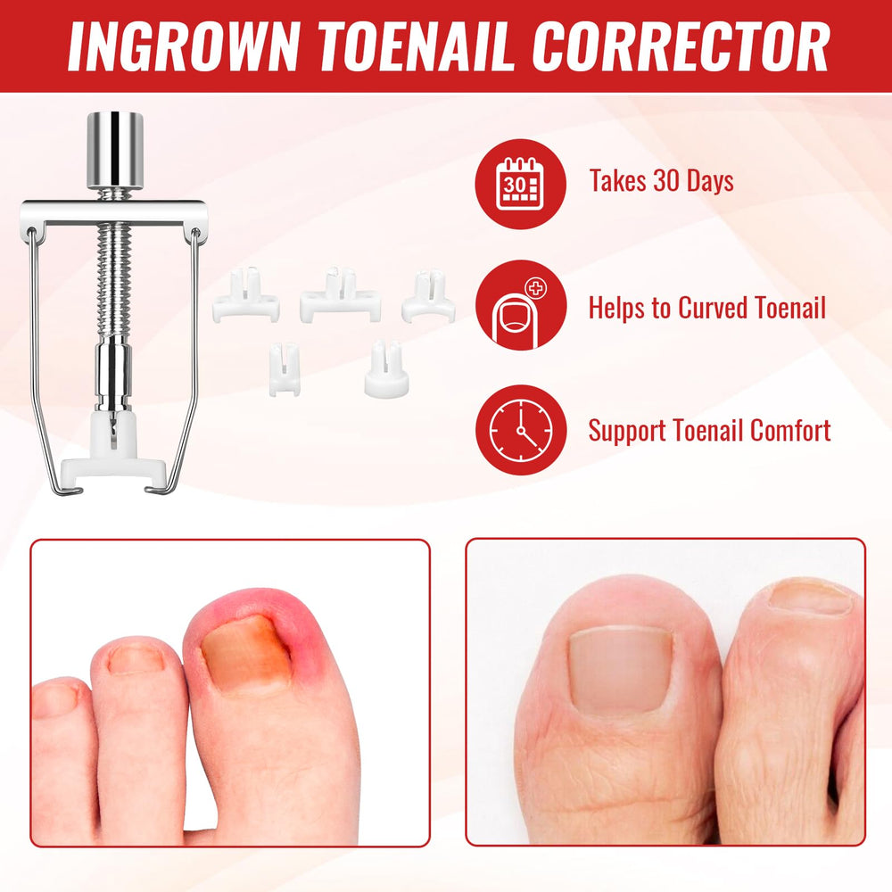 YEQOIZ toenail file lifter helps gentle lifting and shaping.