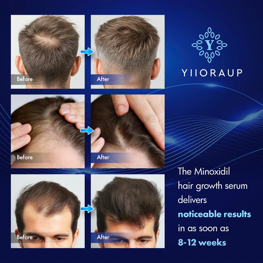 Biotin-infused YIIORAUP formula supports daily scalp care for thin hair.