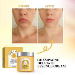 Premium packaging of YILEST Champagne Lift Cream highlights luxury branding.