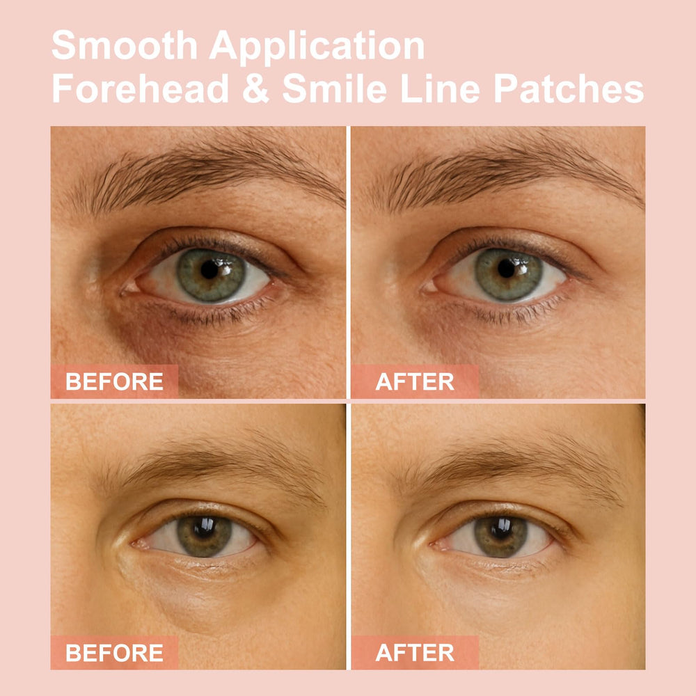 YLOTRE Novalift Micro Eye Patches smooth forehead and smile lines