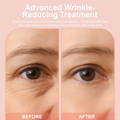 YLOTRE Novalift Micro Eye Patches stay firmly in place during use